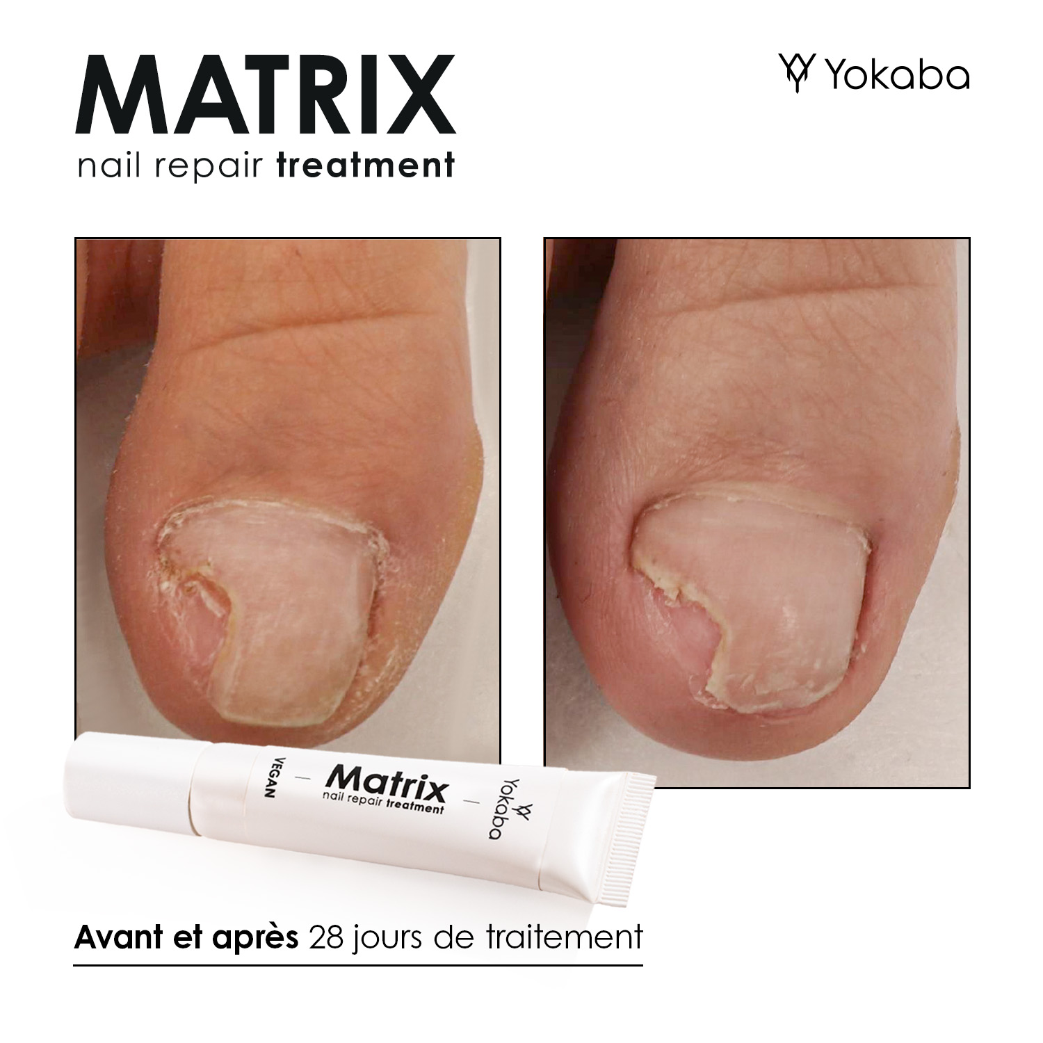 Matrix : Traitement Végan Réparation Ongles et Matrice – Image 12
