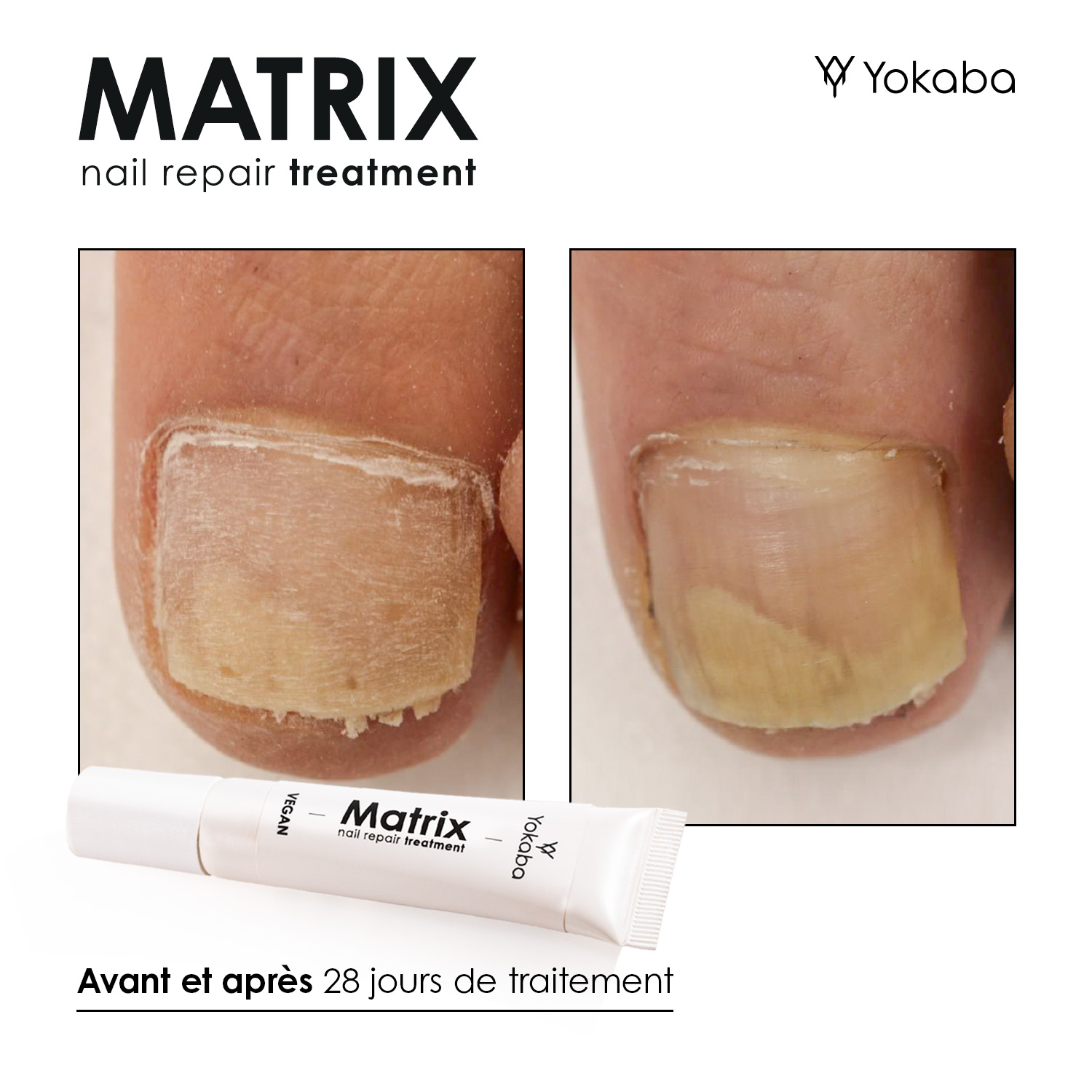 Matrix : Traitement Végan Réparation Ongles et Matrice – Image 11