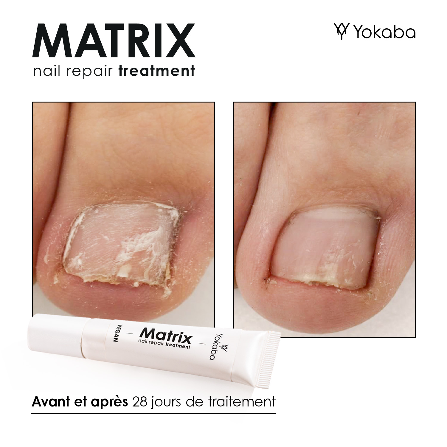 Matrix : Traitement Végan Réparation Ongles et Matrice – Image 10