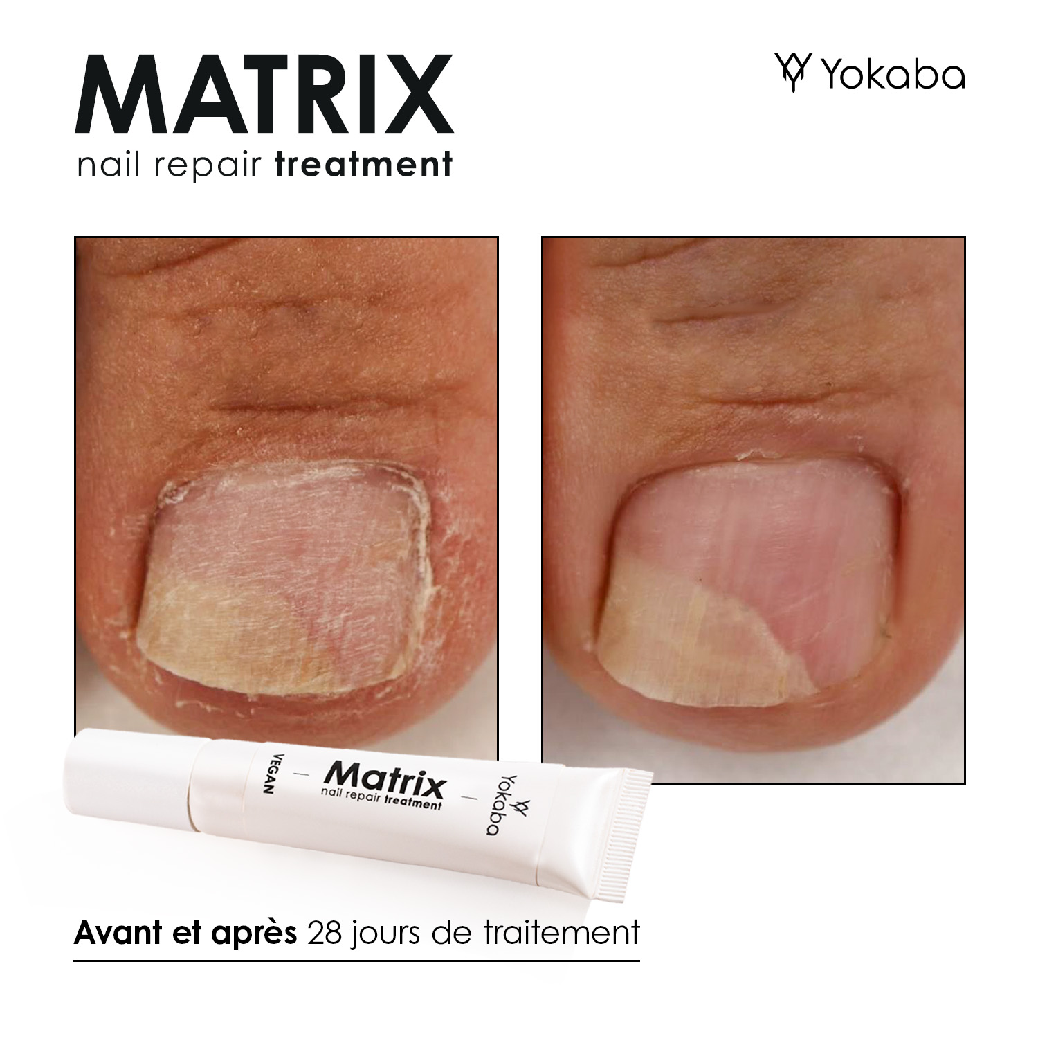 Matrix : Traitement Végan Réparation Ongles et Matrice – Image 9