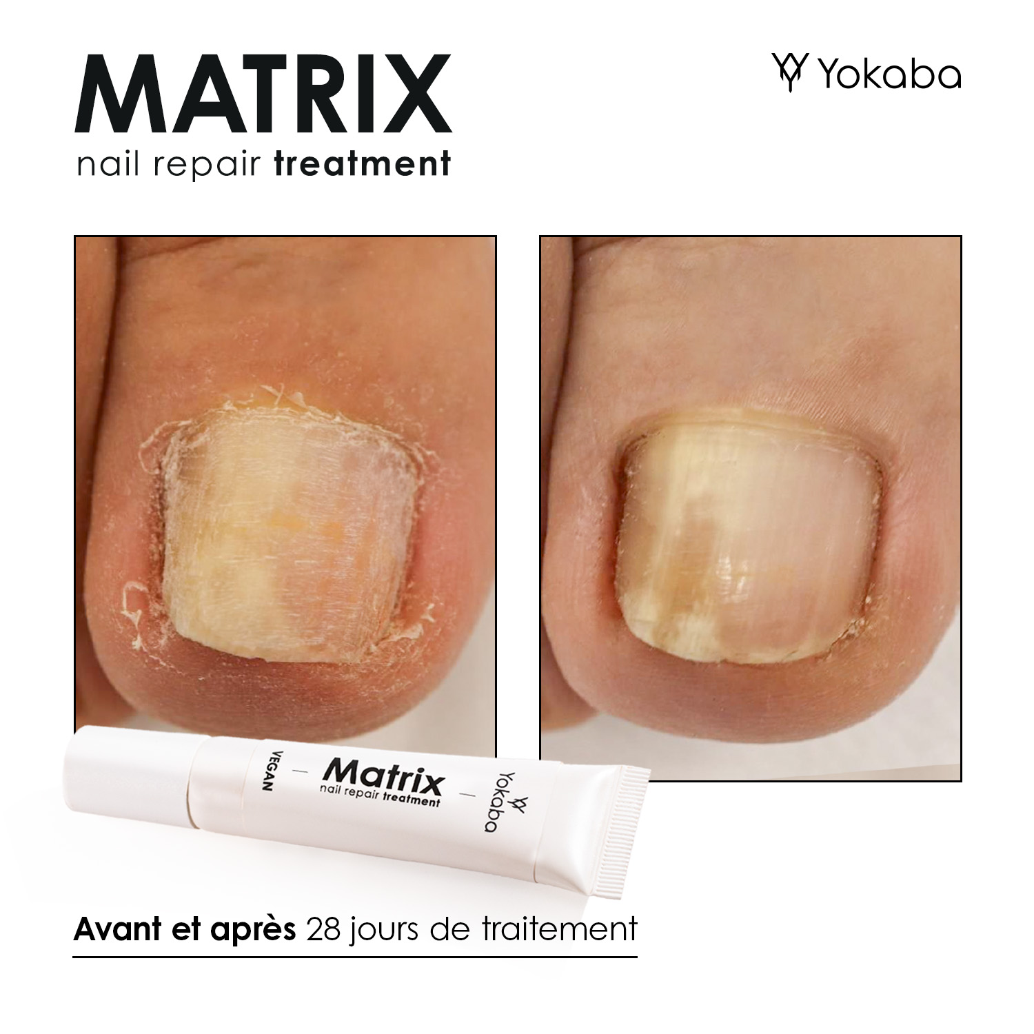 Matrix : Traitement Végan Réparation Ongles et Matrice – Image 8