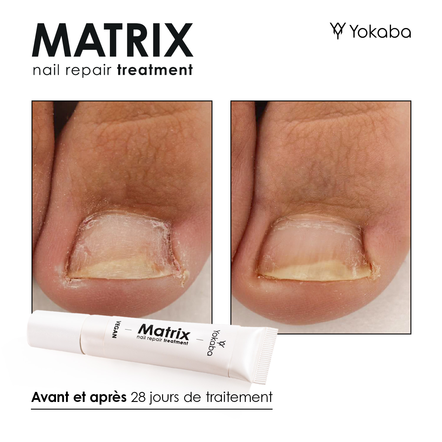 Matrix : Traitement Végan Réparation Ongles et Matrice – Image 7