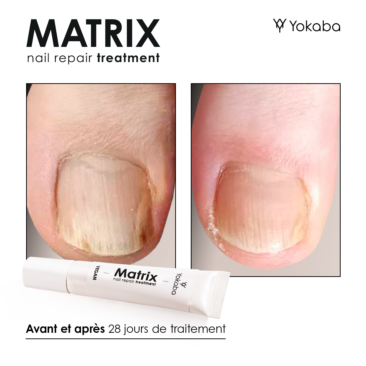 Matrix : Traitement Végan Réparation Ongles et Matrice – Image 6