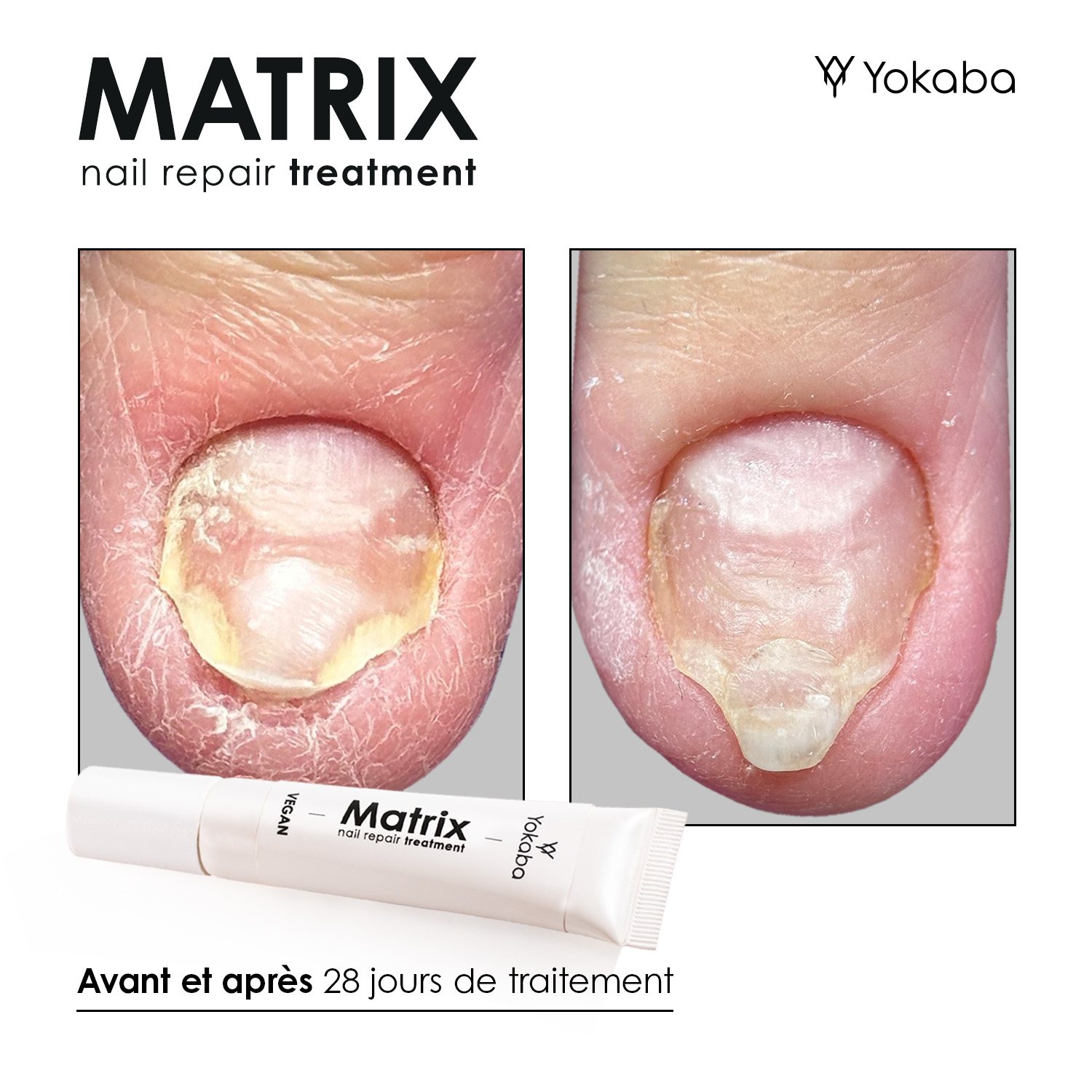 Matrix : Traitement Végan Réparation Ongles et Matrice – Image 5