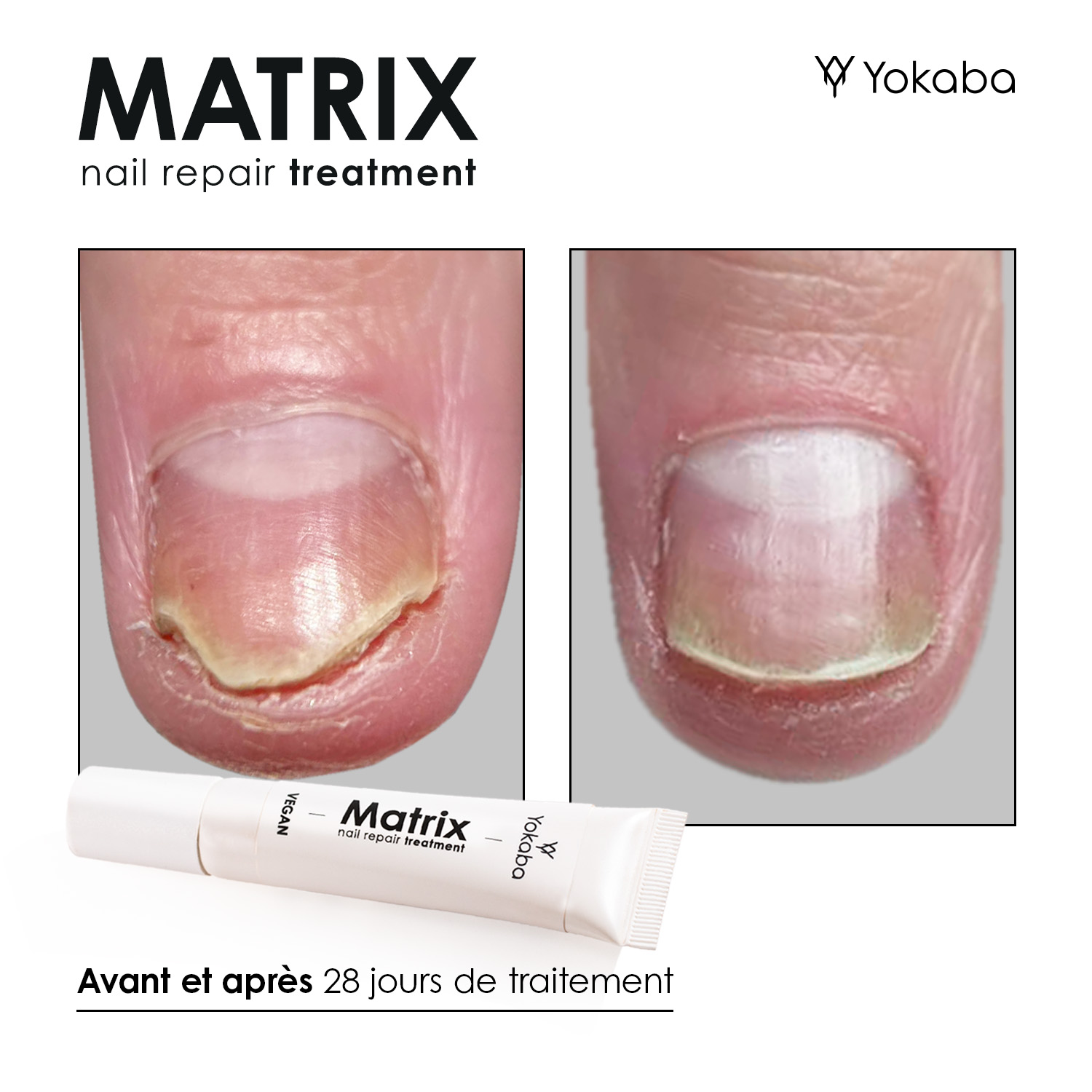 Matrix : Traitement Végan Réparation Ongles et Matrice – Image 4